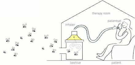 Menyedut udara lebah sarang untuk rawatan asma
